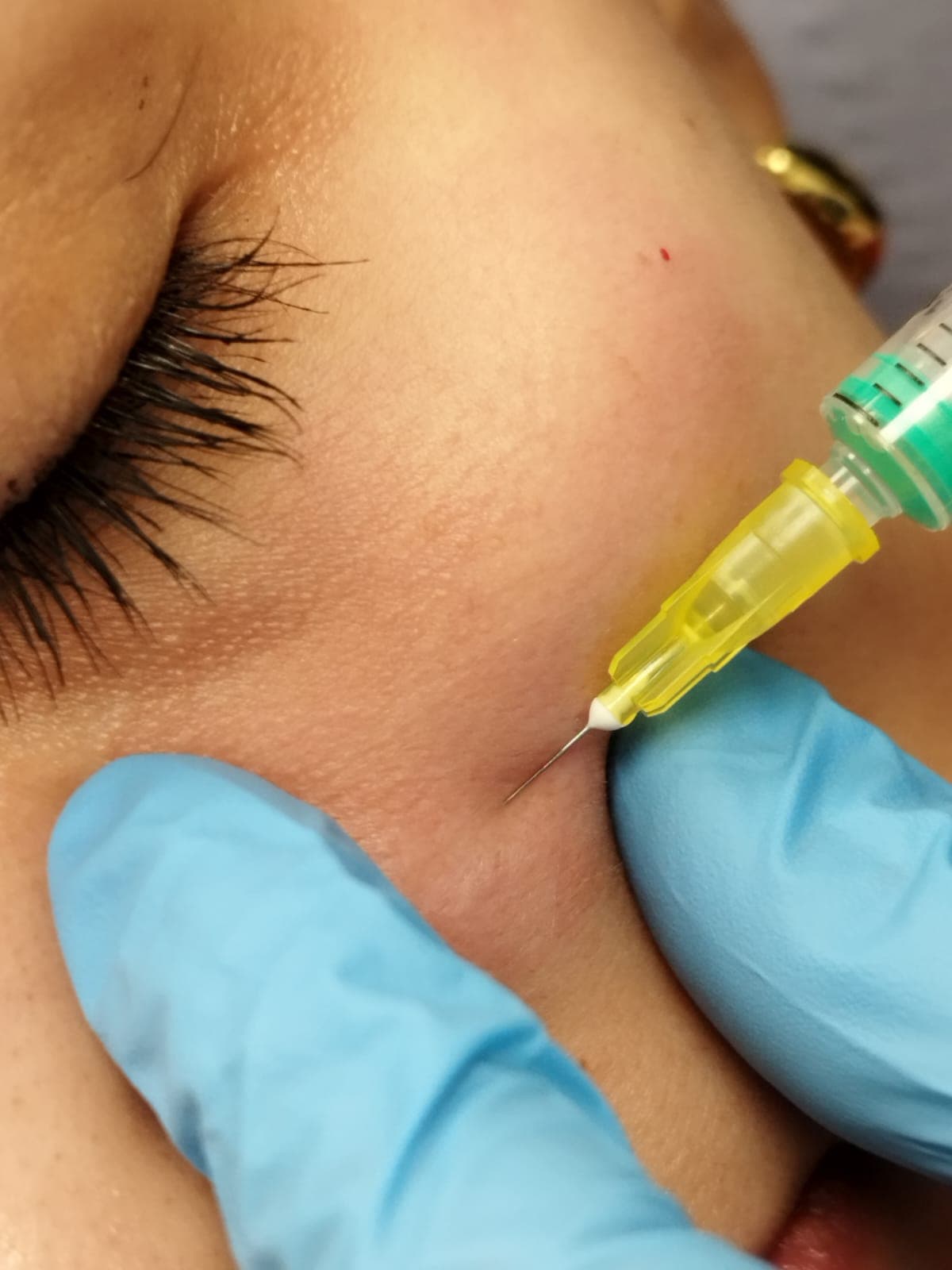 Skin Booster