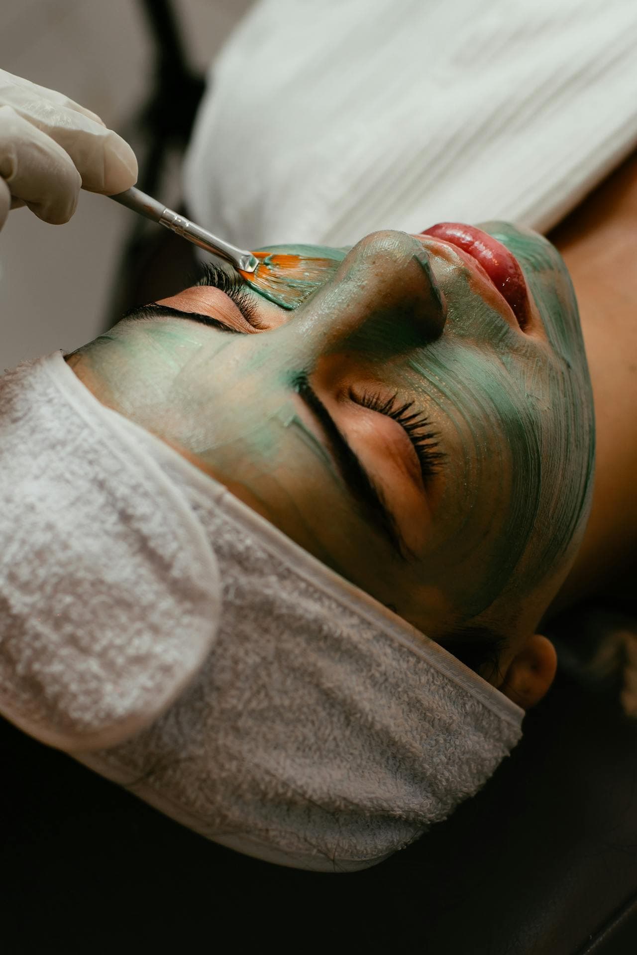 Polynucleotide Treatment: The Next Big Step in Skin Rejuvenation
