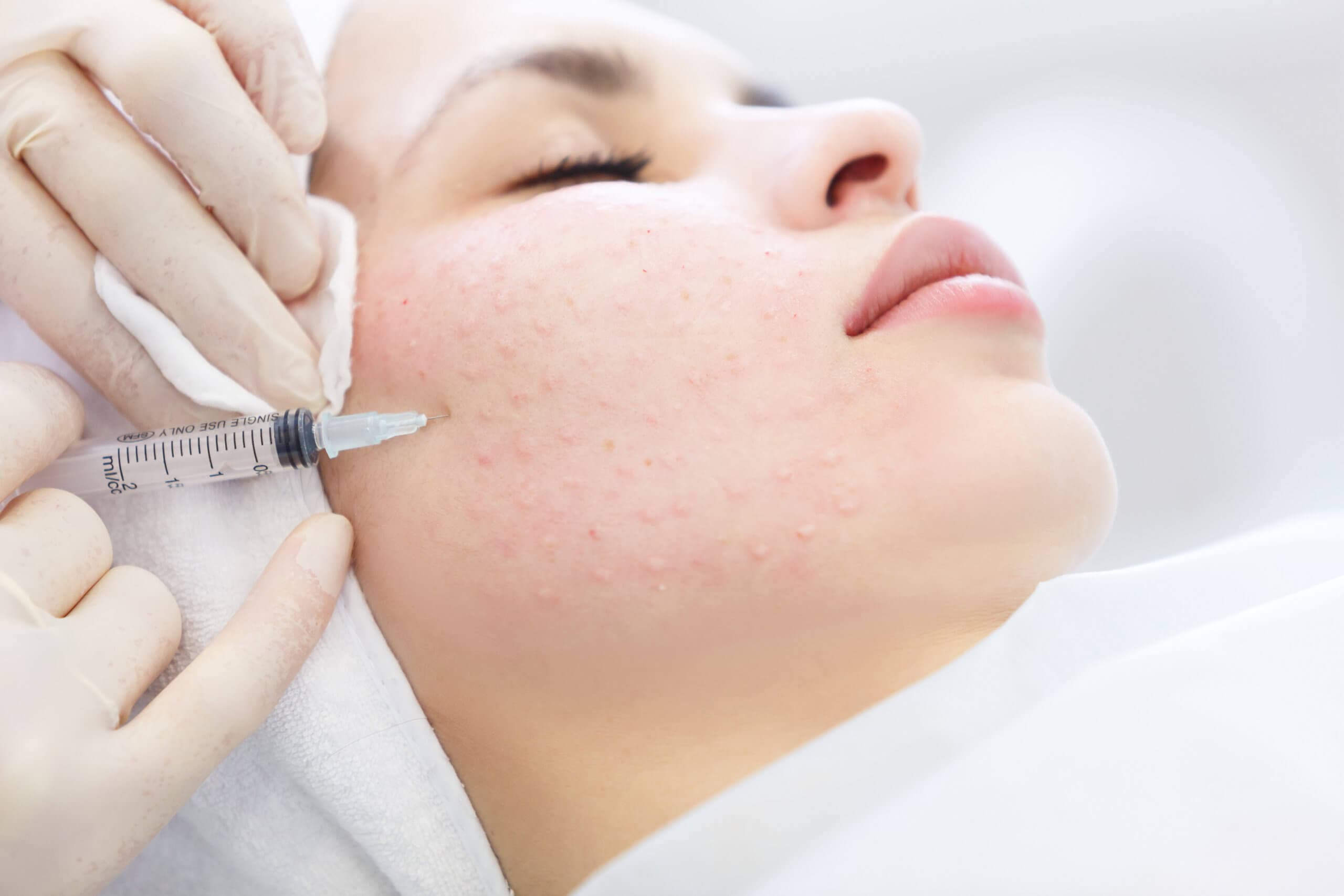 Skincare treatment results