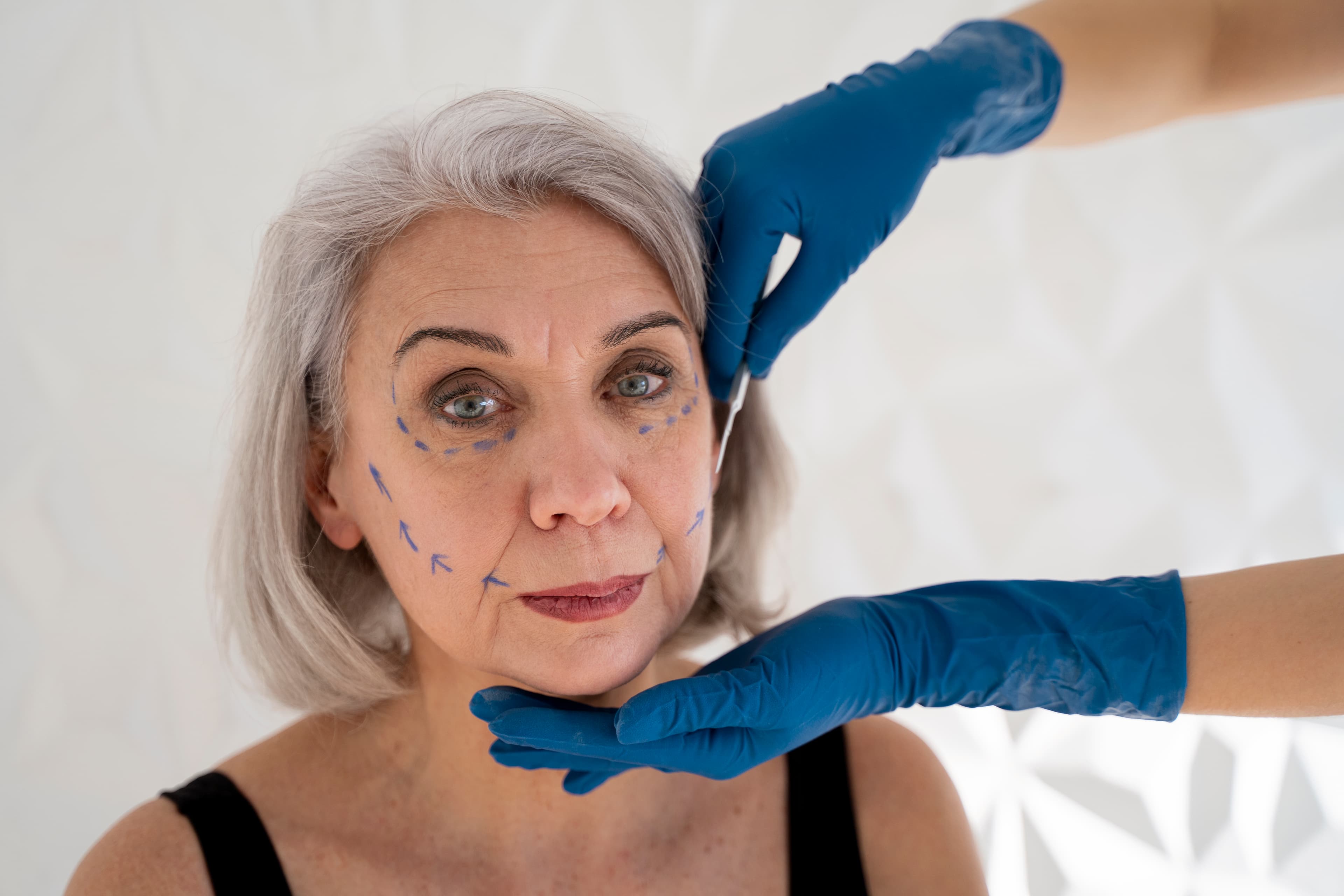 Facial rejuvenation procedure