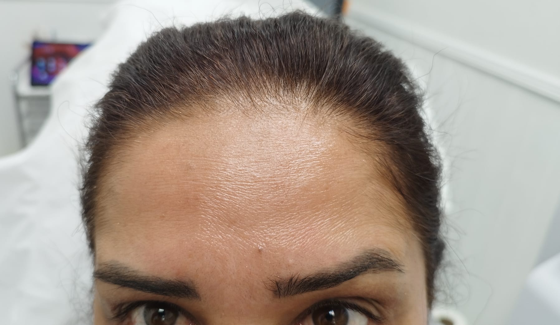 Before